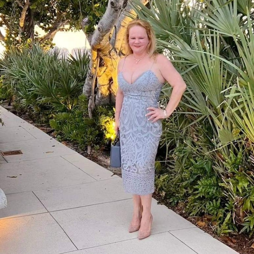 Bardot Lace Midi Dress
